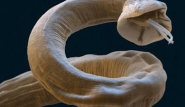 Ascaries Parasit Dina Awak Manusa