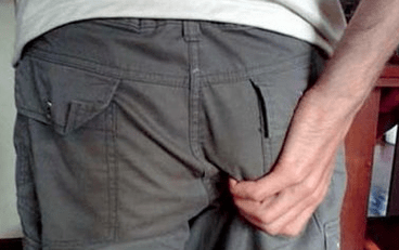 gatal di anus salaku gejala ku ayana parasit