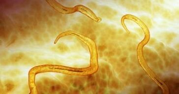 parasit pinworm dina awak manusa