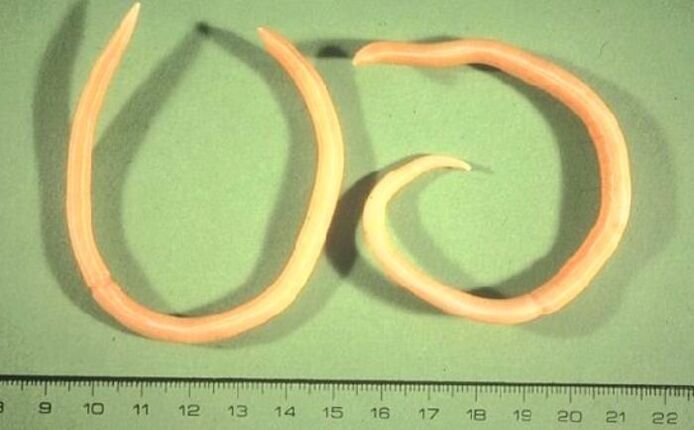 pinworm tina awak manusa