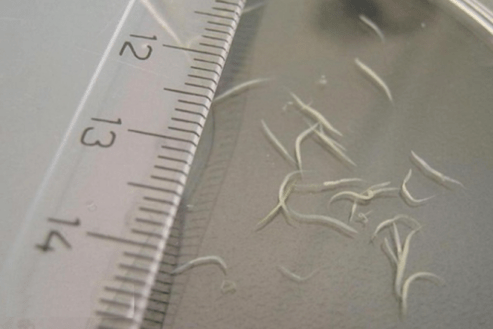 kumaha carana miceun pinworms ti anak
