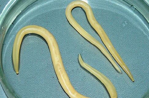 roundworms tina awak anak urang