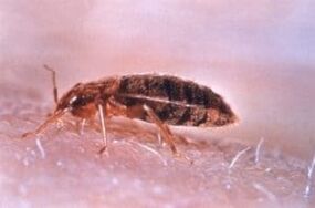 Bed bug nyaéta parasit anu ngahakan getih manusa