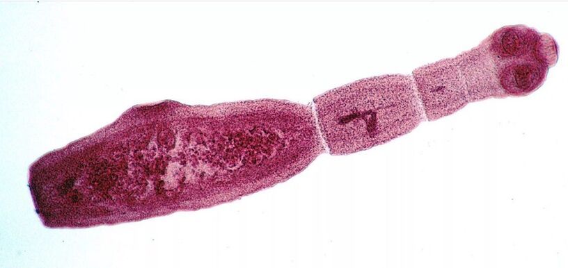 Echinococcus mangrupikeun salah sahiji parasit paling bahaya pikeun manusa