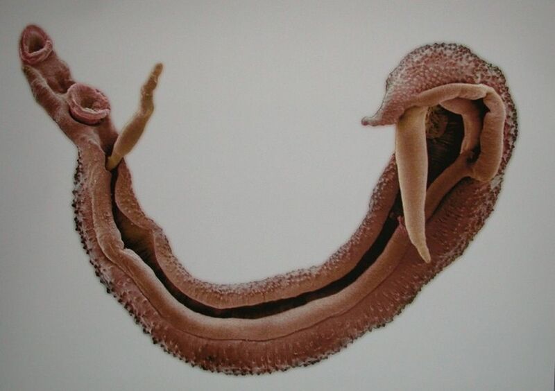 Schistosome mangrupikeun parasit bahaya dina getih manusa