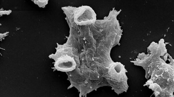 Negleria fowlera mangrupakeun parasit protozoa bahaya pikeun kahirupan manusa. 