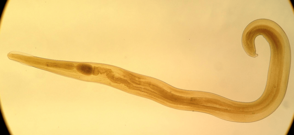 Pinworm mangrupakeun parasit umum diantara barudak. 